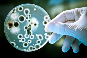 bigstock-Petri-dish-6864555